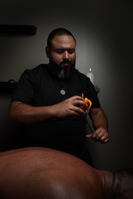 Carlos Blanco lighting a cup for Chinese fire cupping